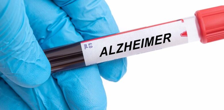 Análisis de sangre para predecir el alzhéimer: comienza una nueva era en la prevención